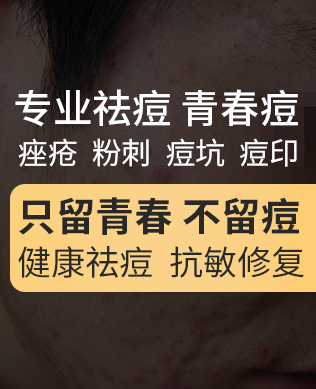 阜阳治疗青春痘医院