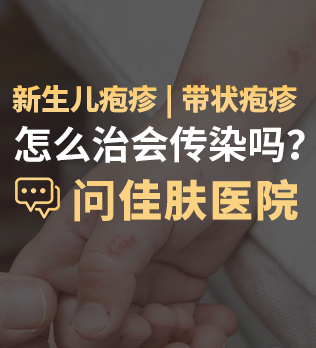 阜阳治疗疱疹医院